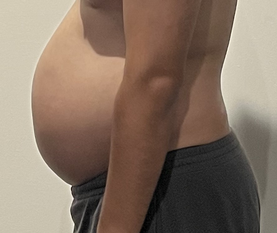 残念ながら、部分痩せダイエットはできません!